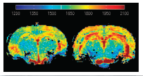 T1 relaxation time is increased in the aging brain